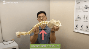 Lumbosacral pain