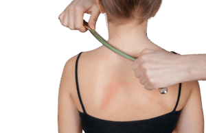 Instrument Assisted Soft Tissue Mobilisation (IASTM)